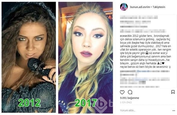 Ece Seçkin'in 'yok artık' dedirten değişimi