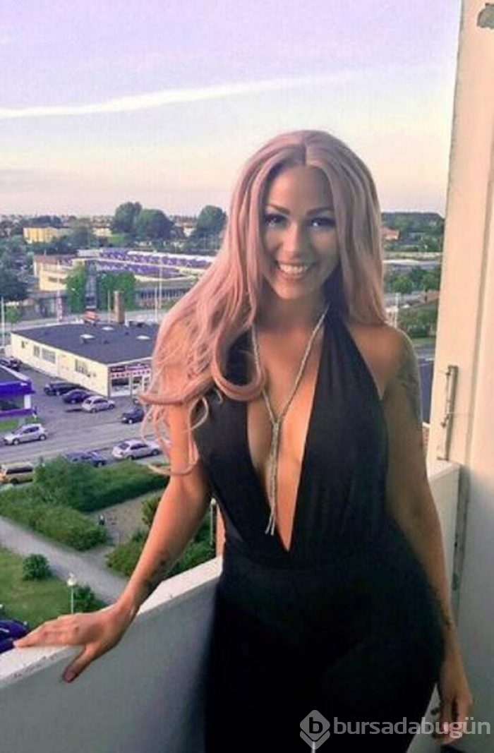 Yıllarca herkesten sakladı peruğunu çıkarınca hayatı değişti