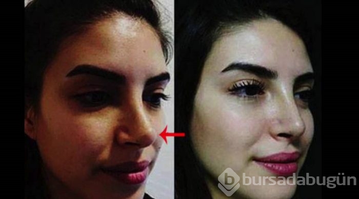 Ünlülerin büyük değişimi