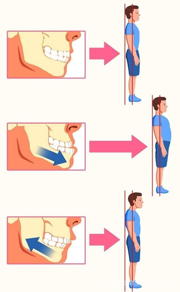 Duruşunuzu düzeltmek için 10 pratik yol
