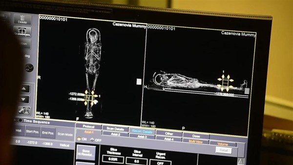 Mumyaların tomografisi çekilince
