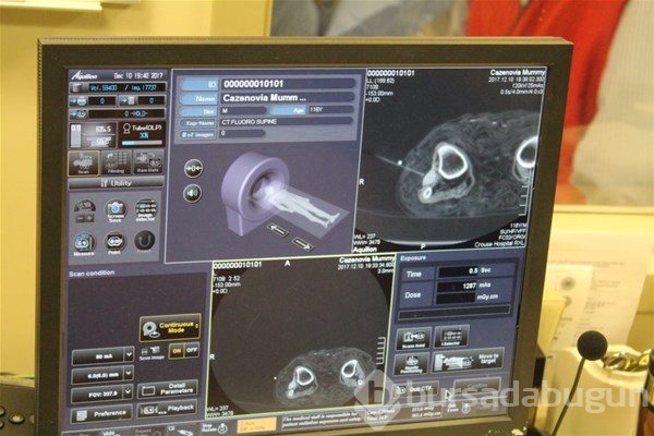 Mumyaların tomografisi çekilince
