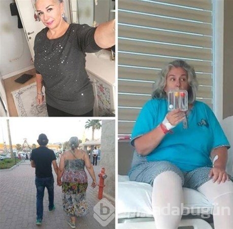 Ünlü değişimler