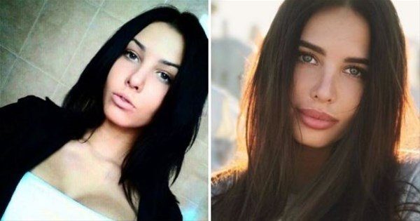 Rus kadınlarının estetikle değişimi