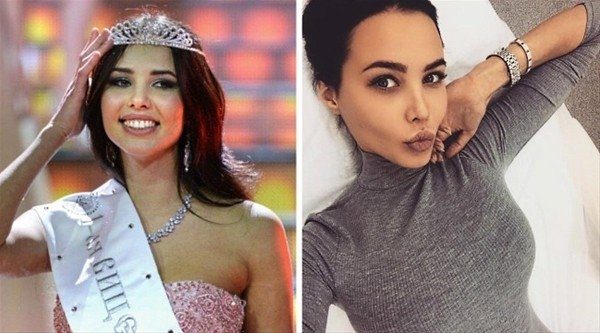 Rus kadınlarının estetikle değişimi