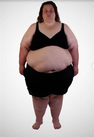 308 kilodan bu hale geldi