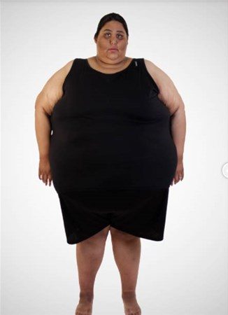 308 kilodan bu hale geldi