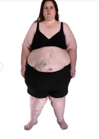 308 kilodan bu hale geldi
