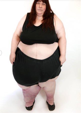 308 kilodan bu hale geldi