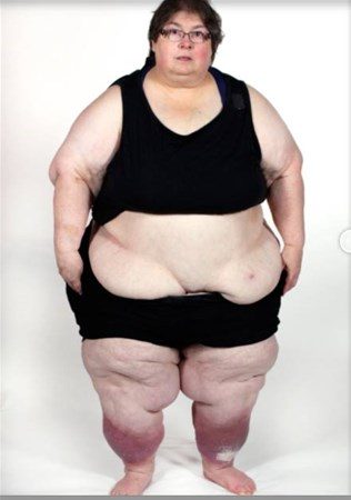 308 kilodan bu hale geldi
