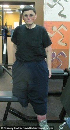 308 kilodan bu hale geldi