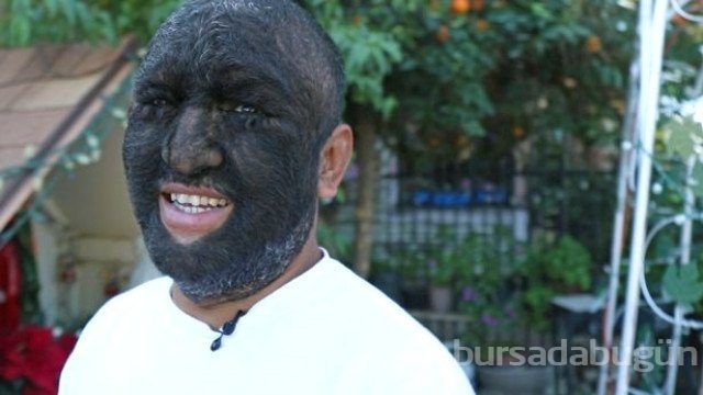 Dünyanın en kıllı adamı artık çok mutlu!