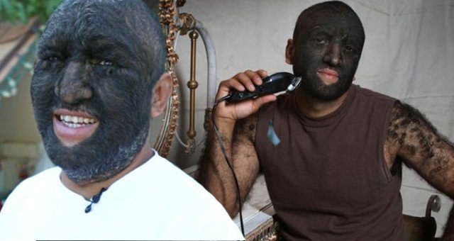 Dünyanın en kıllı adamı artık çok mutlu!