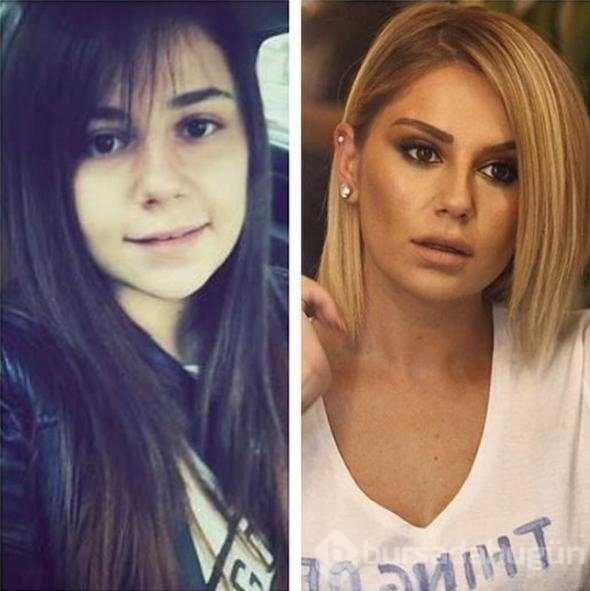 Ünlülerin değişimleri