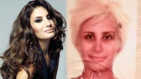Ünlülerin değişimleri