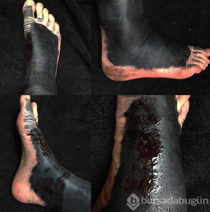 Dövme yaptırdılar sonucu bakın ne oldu!