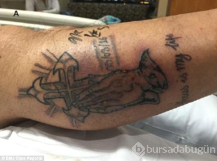 Dövme yaptırdılar sonucu bakın ne oldu!