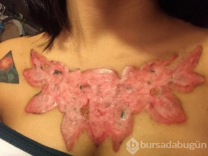 Dövme yaptırdılar sonucu bakın ne oldu!