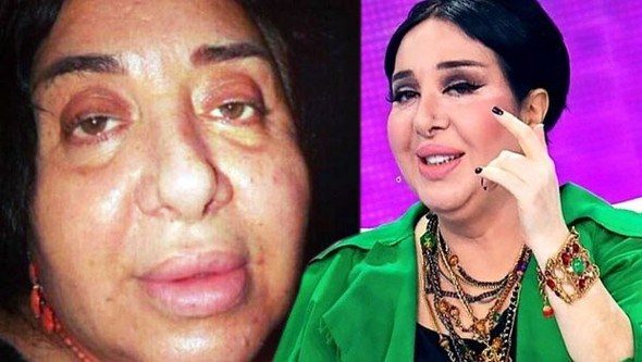Aybüke Pusat makyajsız görüntülendi (Ünlüleri bir de makyajsız görün)

