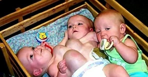 16 yıl önce herkes onları konuşmuştu! Yapışık ikizlerin son halleri
