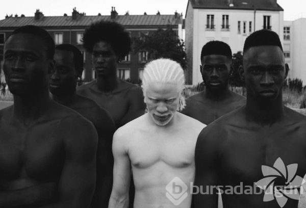 Albino insanlar

