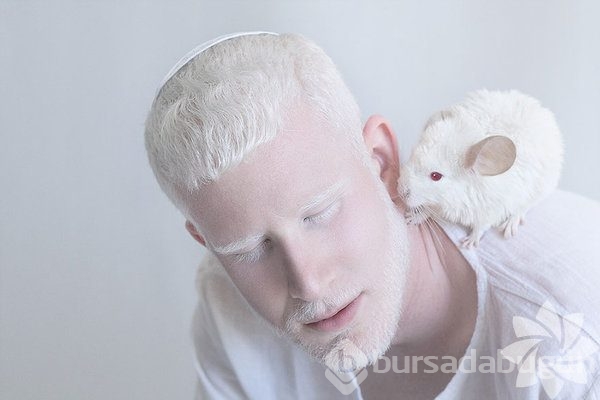 Albino insanlar
