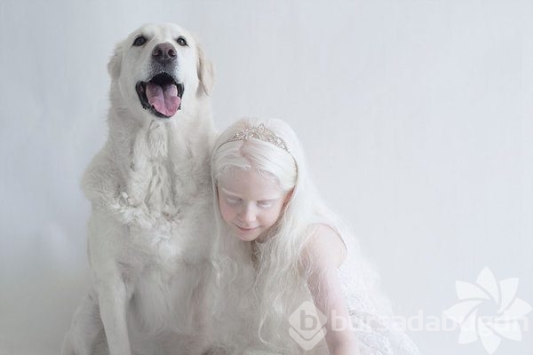 Albino insanlar
