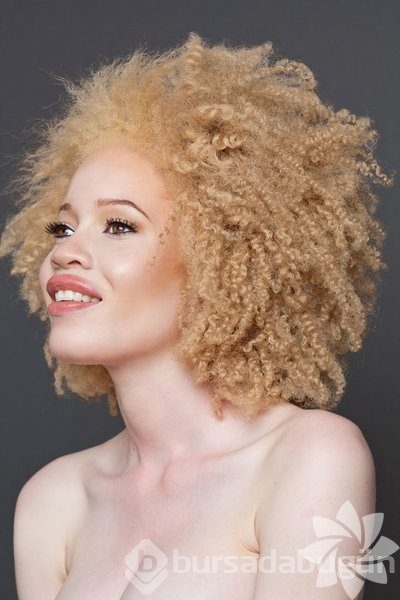albino insanlar foto galerisi 9
