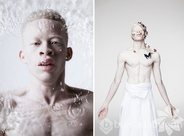 Albino insanlar

