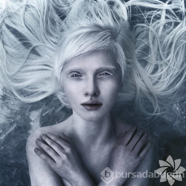 Albino insanlar
