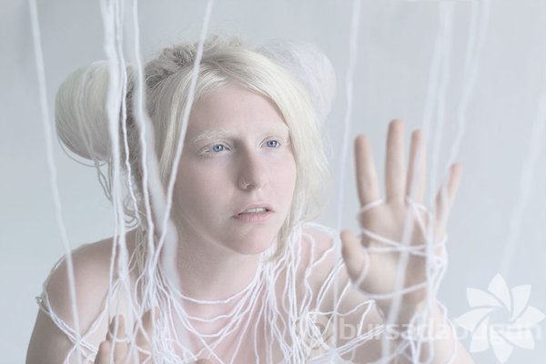 Albino insanlar
