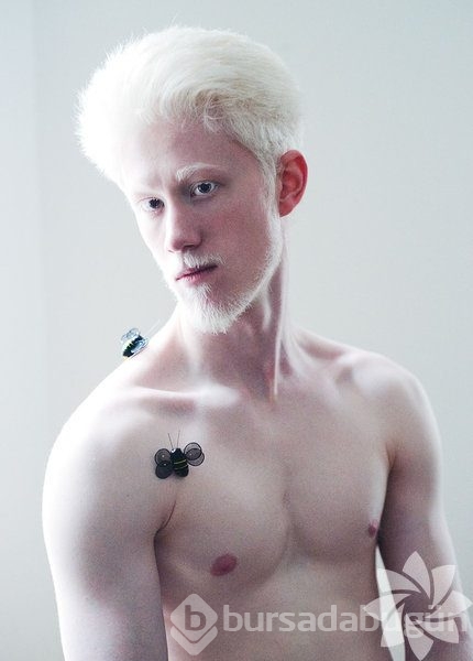 Albino insanlar
