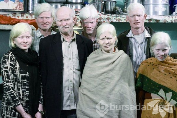 Albino insanlar
