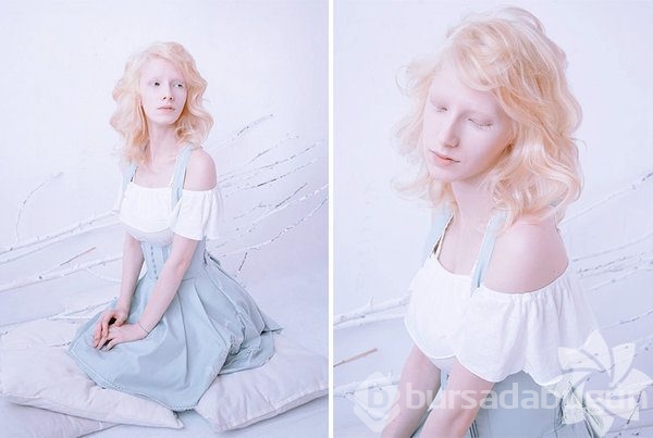 Albino insanlar
