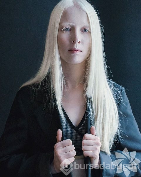 Albino insanlar
