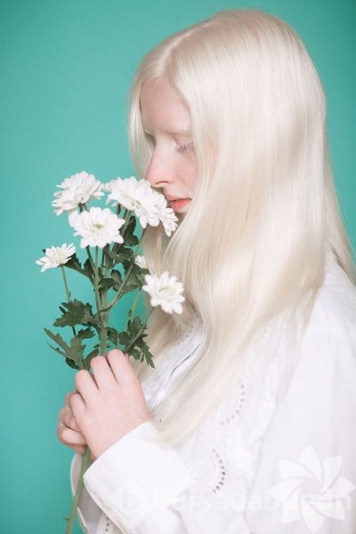 Albino insanlar
