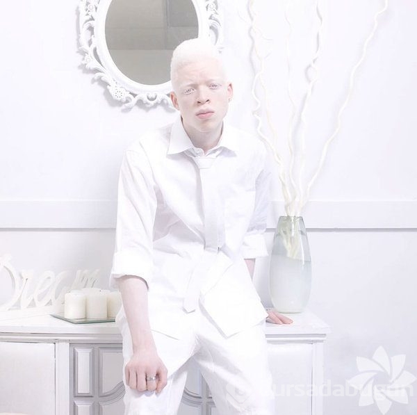 Albino insanlar
