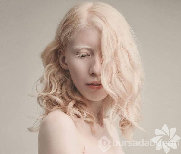 albino insanlar foto galerisi 39