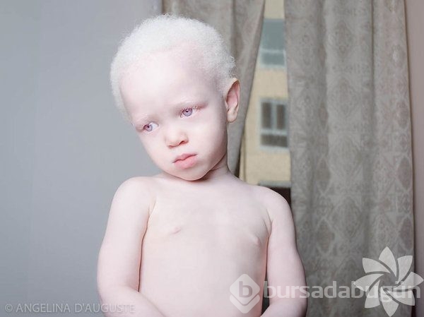 albino insanlar foto galerisi 40