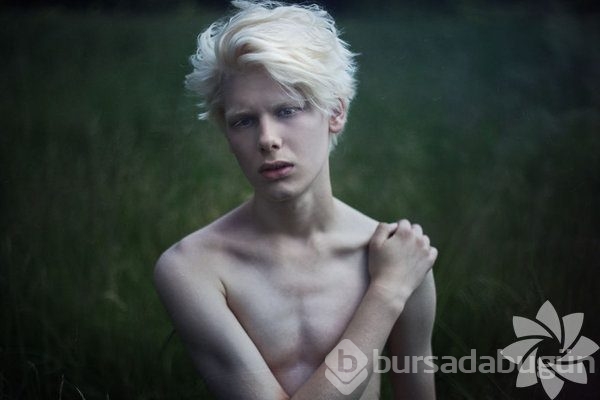 Albino insanlar
