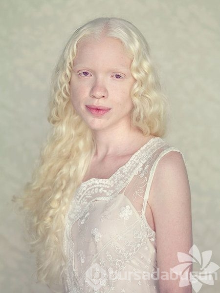 Albino insanlar
