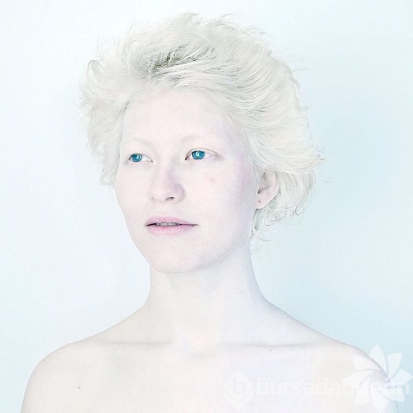 albino insanlar foto galerisi 43