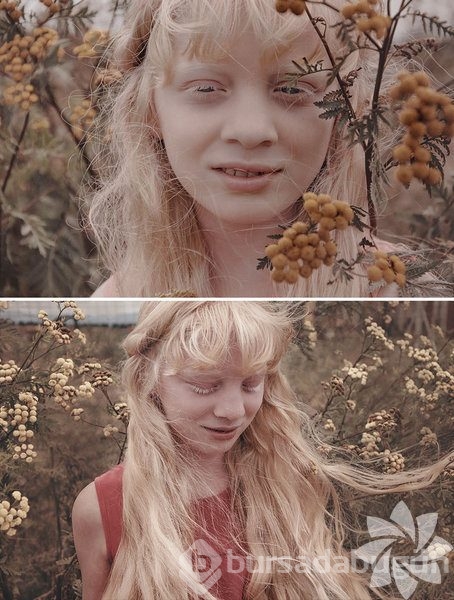 Albino insanlar
