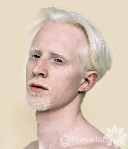 albino insanlar foto galerisi 47