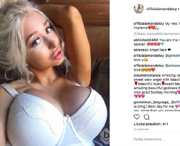 Barbie bebeğe benzemek uğruna ölümden döndü