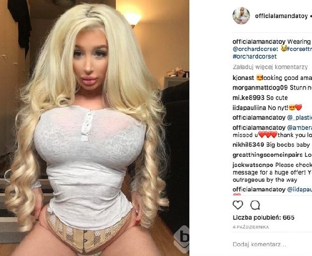 Barbie bebeğe benzemek uğruna ölümden döndü