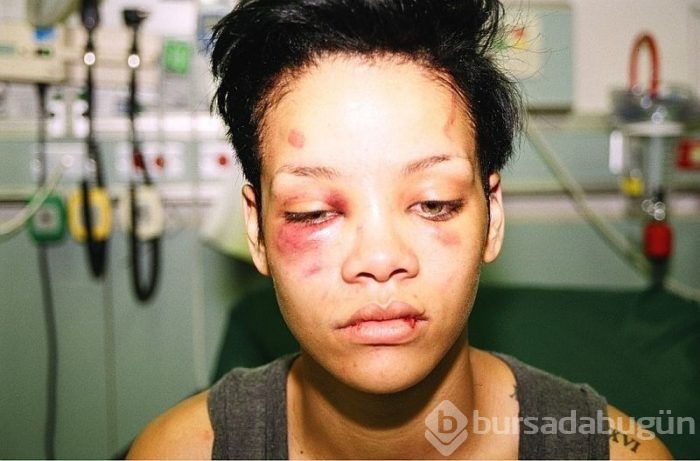 Rihanna'dan Snapchat'e büyük tepki! 