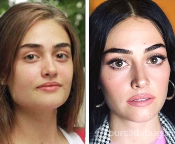 Ünlülerin inanılmaz değişimleri!