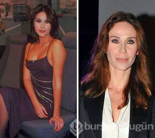 Estetikle bambaşka birine dönüşen Türk ünlüler
