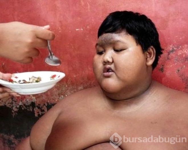 Günde 5 öğün pilav yedi 192 kilo oldu!